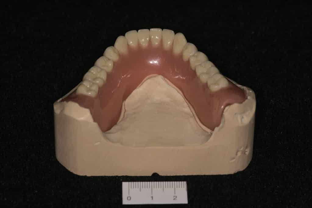 Tota1 Total Prothetik